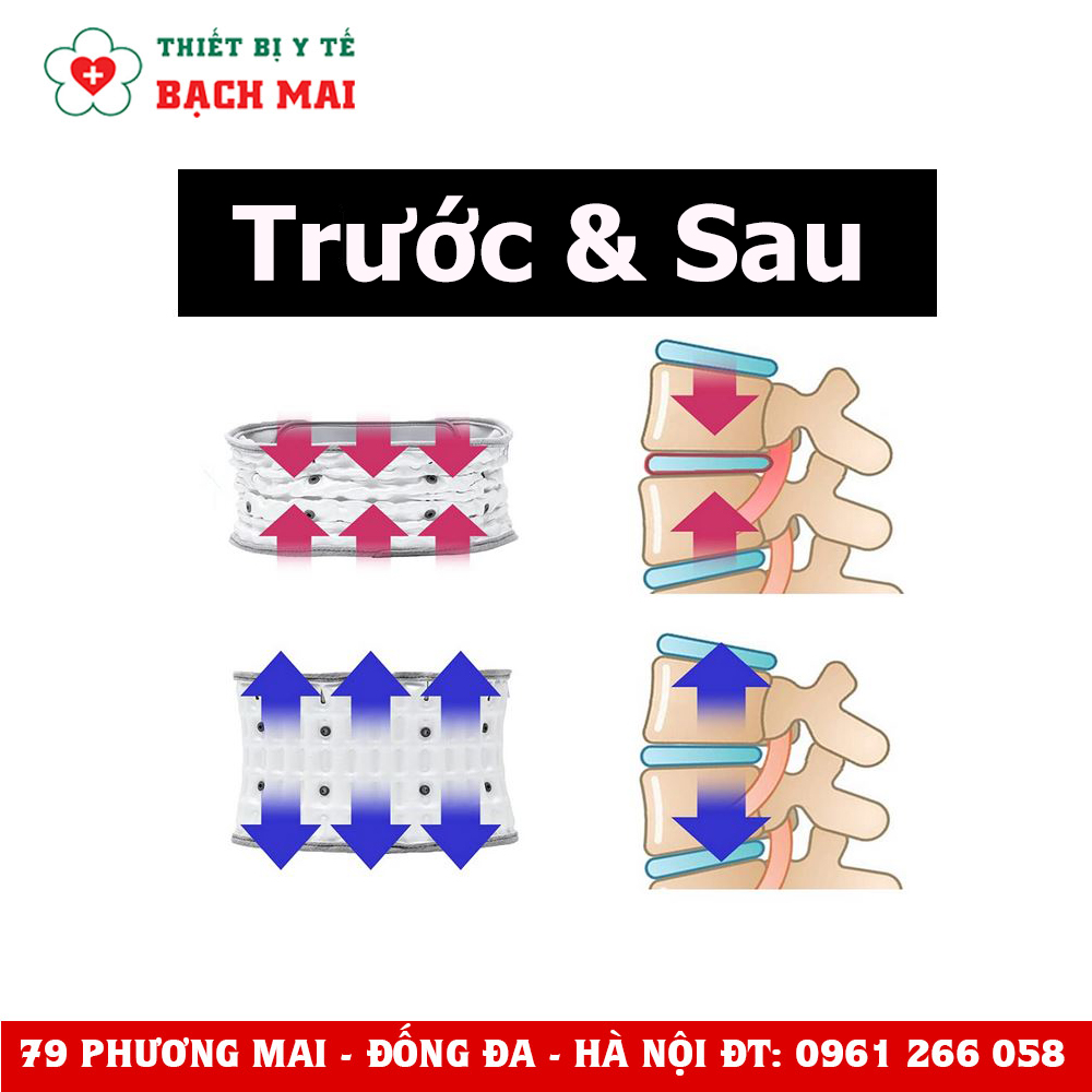 Đai Lưng Bơm Hơi Disk Dr WG50 G2 Đai Lưng Bơm Hơi Disk Dr WG50 G2