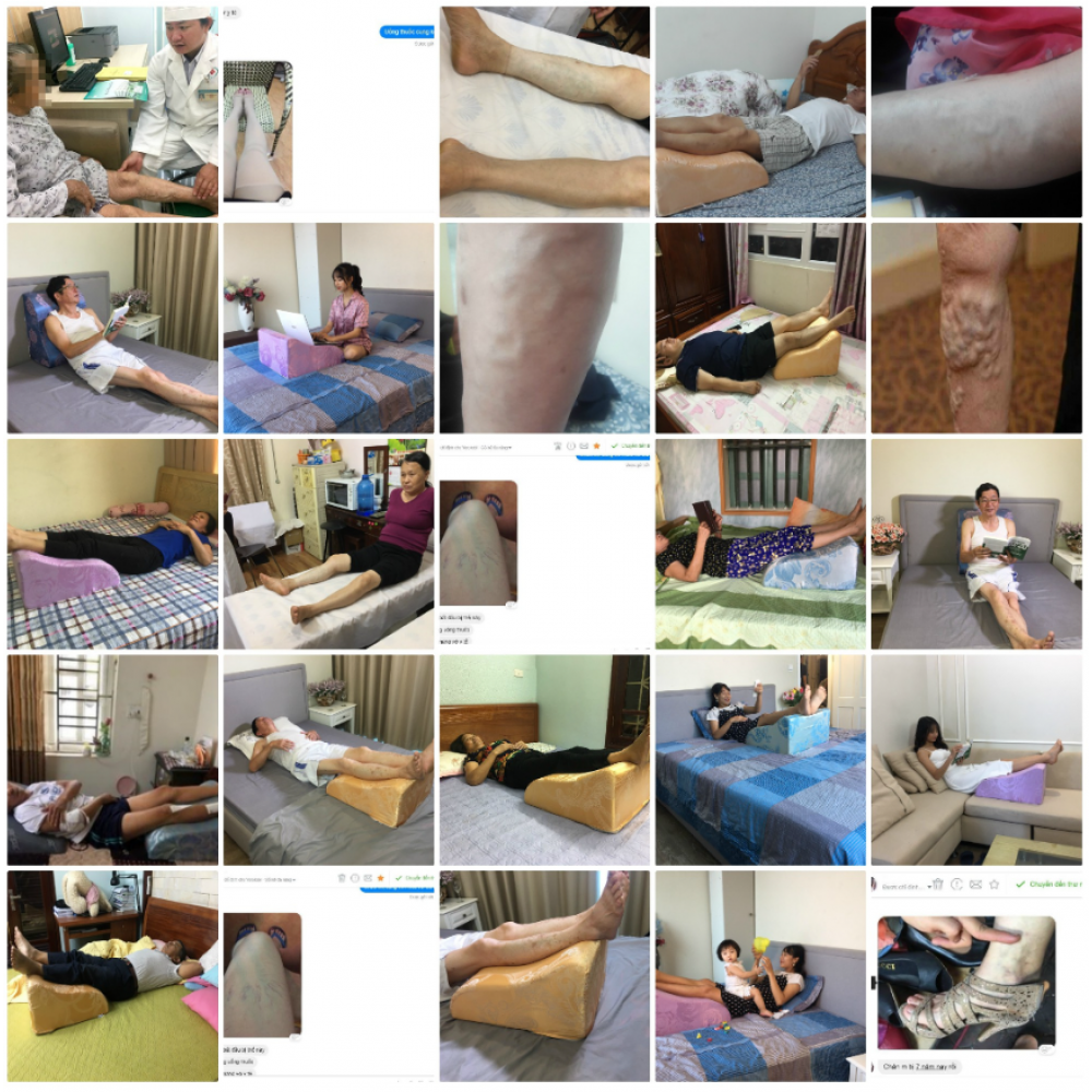 Gối Kê Chân Chống Suy Giãn Tĩnh Mạch YOROKOBI Gối Kê Chân Chống Suy Giãn Tĩnh Mạch YOROKOBI