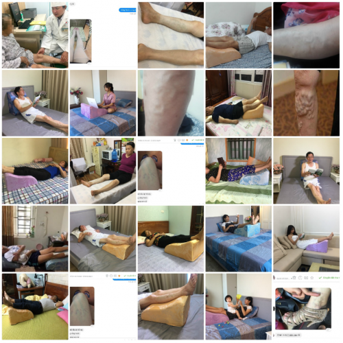 Gối Kê Chân Chống Suy Giãn Tĩnh Mạch YOROKOBI Gối Kê Chân Chống Suy Giãn Tĩnh Mạch YOROKOBI