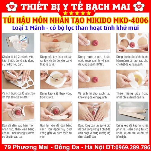 Túi Hậu Môn Nhân Tạo 1 Mảnh MiKiDo MKD-4006 Có Bộ Lọc Than Hoạt Tính Khử Mùi, Kẹp Rời - Hộp 20 Túi Túi Hậu Môn Nhân Tạo 1 Mảnh MiKiDo MKD-4006 Có Bộ Lọc Than Hoạt Tính Khử Mùi, Kẹp Rời - Hộp 20 Túi