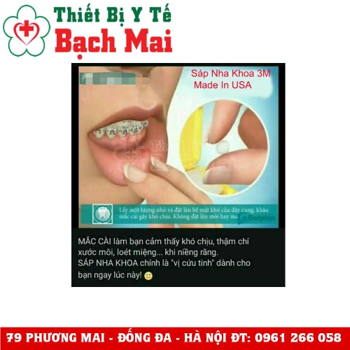 Sáp Nha Khoa Niềng Răng 3M Sáp Nha Khoa Niềng Răng 3M